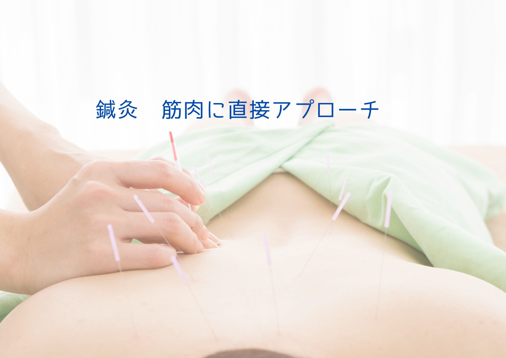 鍼灸　筋肉に直接アプローチ